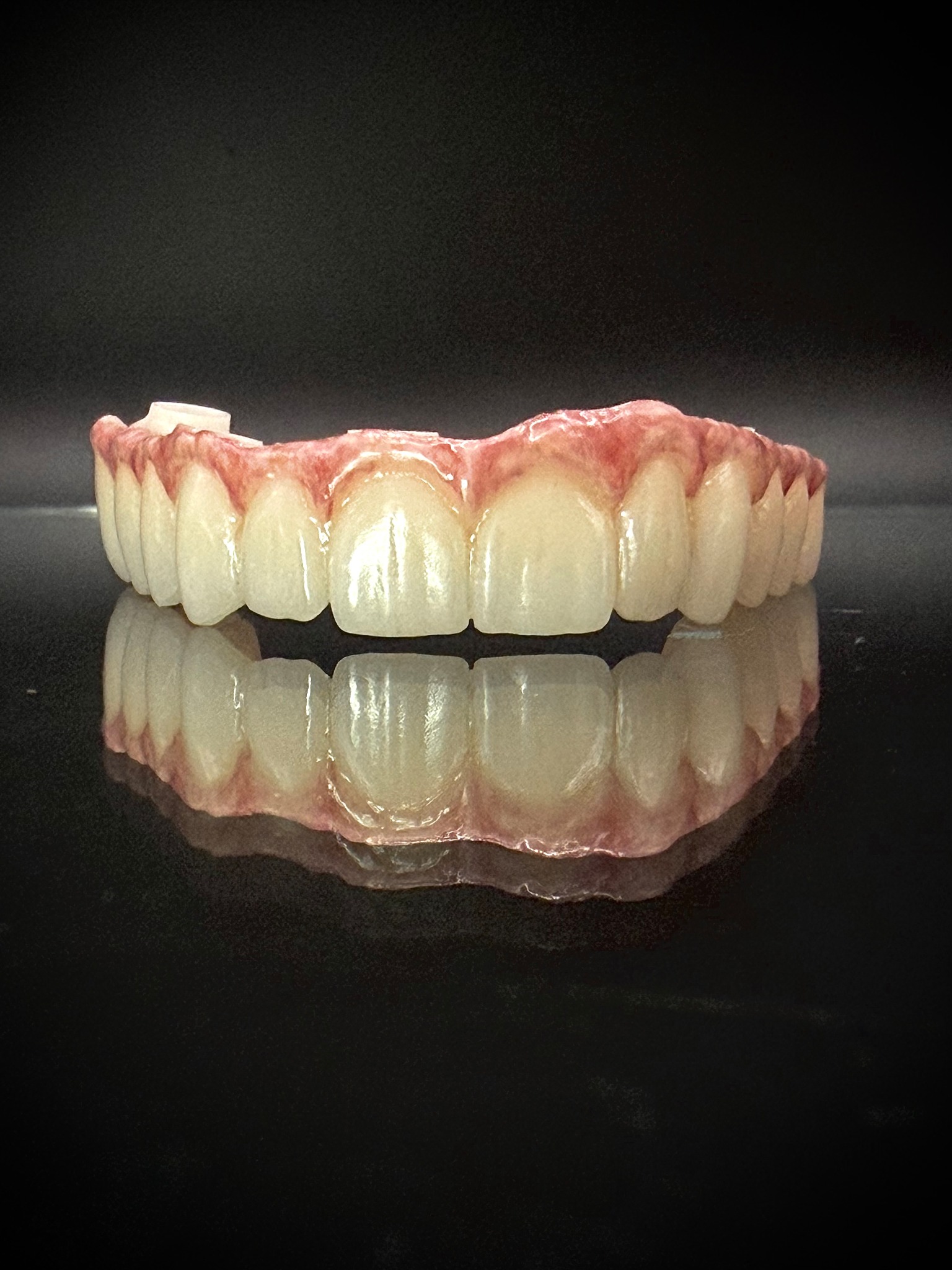 Zirconia full-arch restoration by Red Hollow Dental Lab, shown against a black background